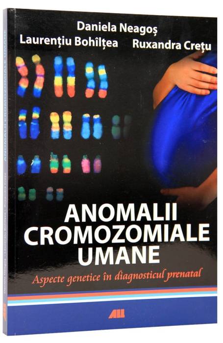 ANOMALII CROMOZOMIALE UMANE